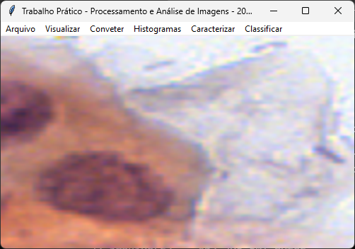 Captura de tela do programa de reconhecimento de células cancerígenas em exames papanicolau